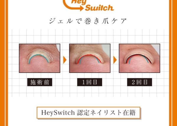 HeySwitch巻き爪ケアセミナー