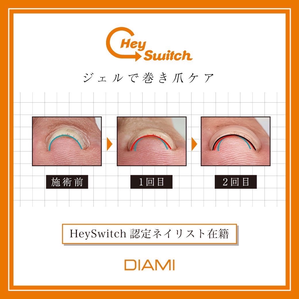 HeySwitch巻き爪ケアセミナーを開催します｜ネイルスクールなら東京