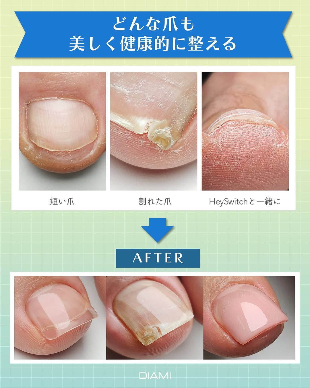 どんな爪も美しく健康的に整える